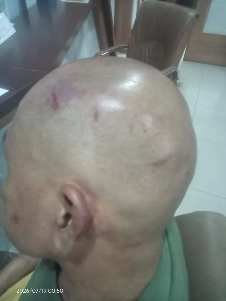 Kronologi Singkat: Kasus Dugaan Penganiayaan Aktivis LSM Memanas, Gelombang Unjuk Rasa Ancam Rangkasbitung